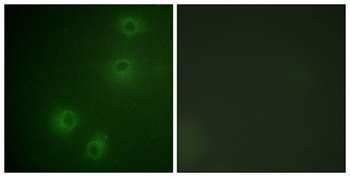 Integrin β1 (phospho Thr789) rabbit pAb Antibody