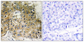 Integrin β1 (phospho Thr789) rabbit pAb Antibody