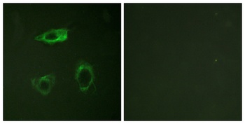 Integrin β2 (phospho Thr758) rabbit pAb Antibody
