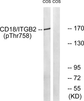 Integrin β2 (phospho Thr758) rabbit pAb Antibody