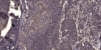 Integrin β2 (phospho Thr758) rabbit pAb Antibody