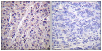A-Raf (phospho Tyr302) rabbit pAb Antibody
