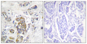 Integrin β4 (phospho Tyr1510) rabbit pAb Antibody