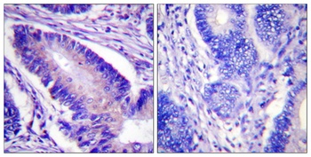 eIF4B (phospho Ser422) rabbit pAb Antibody