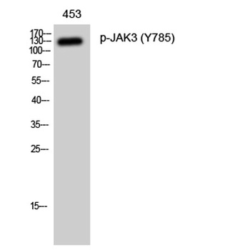 JAK3 (phospho Tyr785) rabbit pAb Antibody