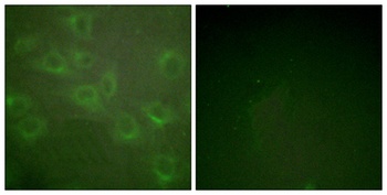 Kv1.3 (phospho Tyr187) rabbit pAb Antibody