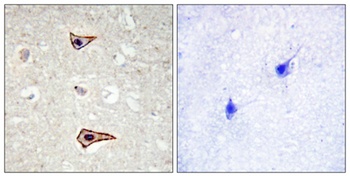 Kv1.3 (phospho Tyr187) rabbit pAb Antibody
