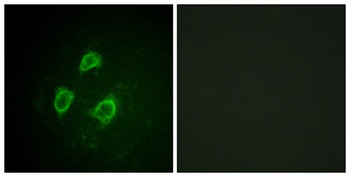 Kv2.1 (phospho Ser567) rabbit pAb Antibody