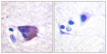 Kv2.1 (phospho Ser567) rabbit pAb Antibody