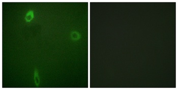 ROM-K (phospho Ser44) rabbit pAb Antibody