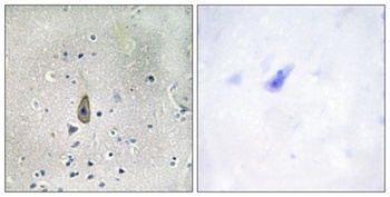ROM-K (phospho Ser44) rabbit pAb Antibody