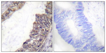 KIR3.1 (phospho Ser185) rabbit pAb Antibody