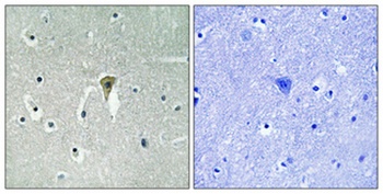 KIR6.2 (phospho Thr224) rabbit pAb Antibody