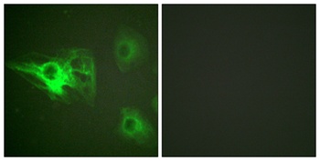Cytokeratin 8 (phospho Ser432) rabbit pAb Antibody