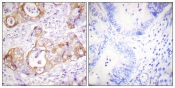 Cytokeratin 8 (phospho Ser432) rabbit pAb Antibody