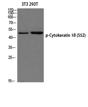 Cytokeratin 18 (phospho Ser52) rabbit pAb Antibody