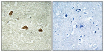 Cytokeratin 18 (phospho Ser52) rabbit pAb Antibody