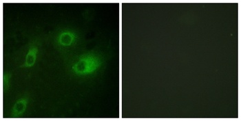 Cytokeratin 18 (phospho Ser52) rabbit pAb Antibody