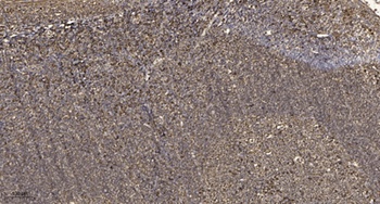 Rho B rabbit pAb Antibody