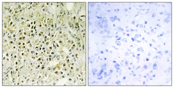 Galectin-8 rabbit pAb Antibody