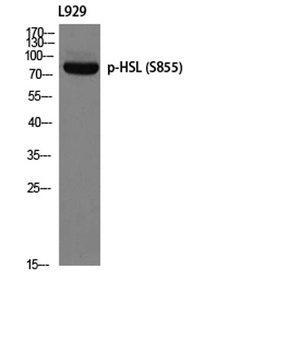 HSL (phospho Ser855) rabbit pAb Antibody