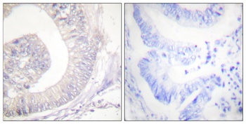 HSL (phospho Ser855) rabbit pAb Antibody