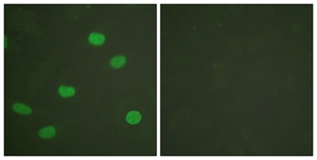 Lamin A/C (phospho Ser392) rabbit pAb Antibody