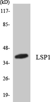 LSP1 rabbit pAb Antibody