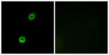 MARCKS rabbit pAb Antibody