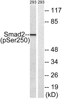 Smad2 (phospho Ser250) rabbit pAb Antibody