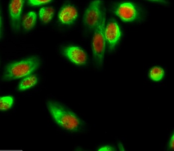 Smad4 rabbit pAb Antibody