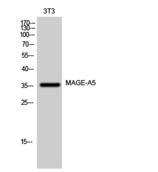 MAGE-A5 rabbit pAb Antibody