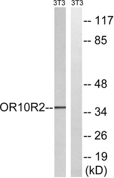 MAGE-A5 rabbit pAb Antibody