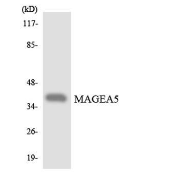 MAGE-A5 rabbit pAb Antibody