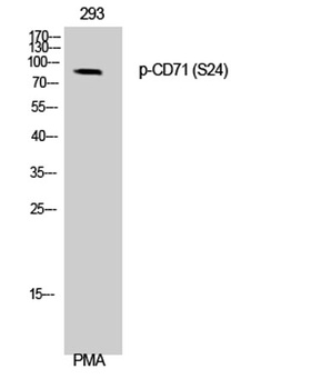 CD71/TfR (phospho Ser24) rabbit pAb Antibody