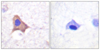 CD71/TfR (phospho Ser24) rabbit pAb Antibody