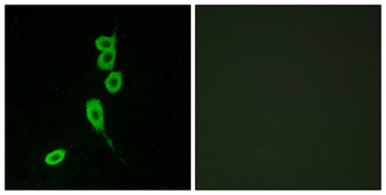 MC1-R rabbit pAb Antibody