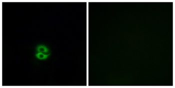 CHST6 rabbit pAb Antibody