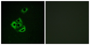 Mcl-1 (phospho Ser159) rabbit pAb Antibody