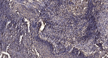 Mcl-1 (phospho Ser159) rabbit pAb Antibody