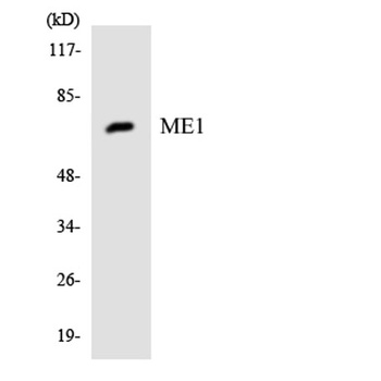 Malic enzyme 1 rabbit pAb Antibody