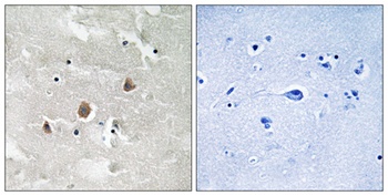 MEK Kinase-1 (phospho Thr1402) rabbit pAb Antibody