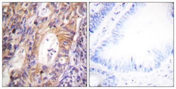 Met (phospho Tyr1003) rabbit pAb Antibody