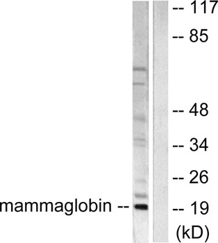 Mammaglobin A rabbit pAb Antibody