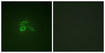 Mucin 1 (phospho Tyr1229) rabbit pAb Antibody
