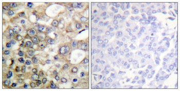 Mucin 1 (phospho Tyr1229) rabbit pAb Antibody