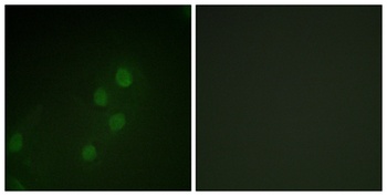 Myf-5 rabbit pAb Antibody
