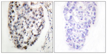 Myf-5 rabbit pAb Antibody