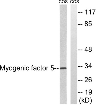 Myf-5 rabbit pAb Antibody