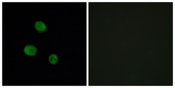 hnRNP M rabbit pAb Antibody